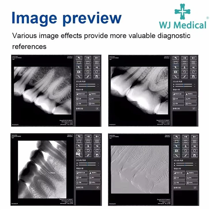 X-ray Digital Sensor